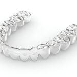 Invisalign Benefits with Expert Dentists in Texas at Taylor Dental and Braces_FI