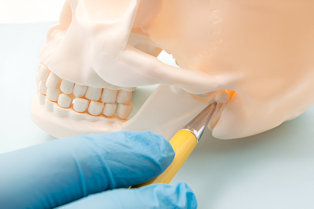 Comprehensive Guide to TMJ Symptoms and Treatment at Taylor Dental and Braces, Texas_3