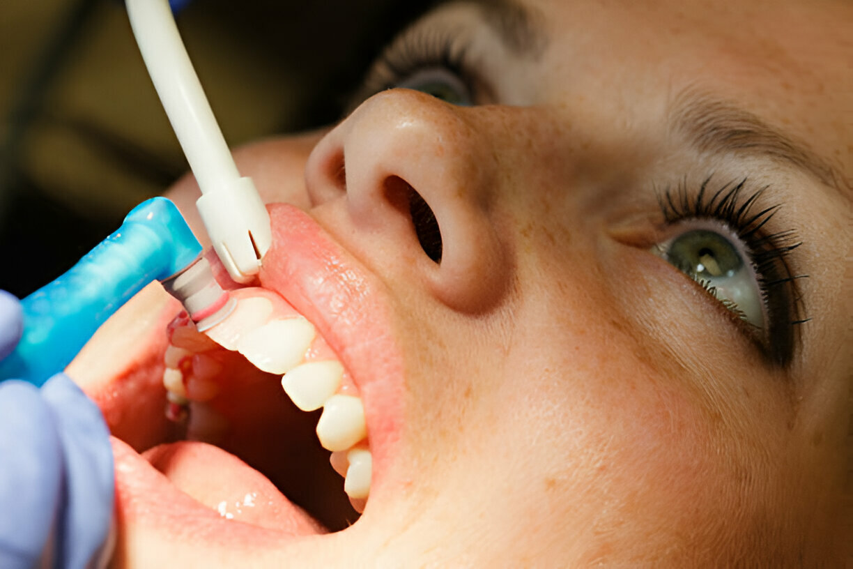 Comprehensive Dental Exams & Cleanings at Taylor Dental and Braces in Texas_2