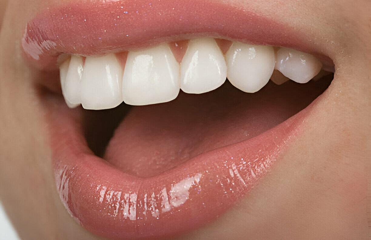 Your Guide to Cosmetic Dentistry: Why Taylor Dental and Braces is the Go-To Choice in Texas_FI